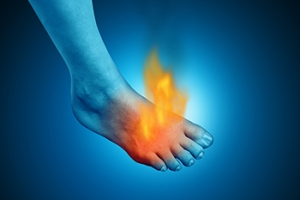 When Toes Burn and What It Could Mean