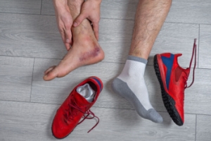 Types and Grades of Ankle Sprains