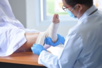Symptoms of a Broken Ankle