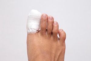 Causes of a Broken Toe