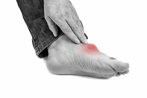 Symptoms of Gout