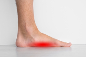 Flat Feet in Adults