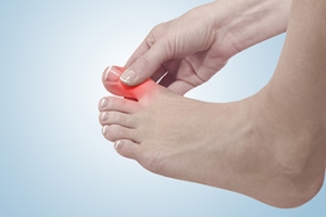 Understanding the Differences Between Gout and Bunions